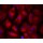 LiFluor™ 555 Fluorescent Dye (5 mg)