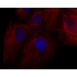 LiFluor™ 610 Fluorescent Dye (5 mg)