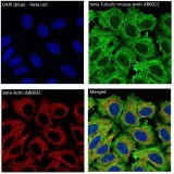 β-Actin Rabbit Monoclonal Antibody (100 μl)