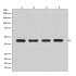 β-Actin Rabbit Monoclonal Antibody (100 μl)