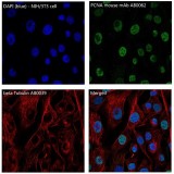 β-Tubulin Rabbit Polyclonal Antibody (100 μl)