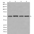 β-Tubulin Rabbit Polyclonal Antibody (100 μl)