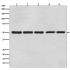 β-Tubulin Mouse Monoclonal Antibody (100 μl)