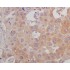 β-Tubulin Mouse Monoclonal Antibody (100 μl)