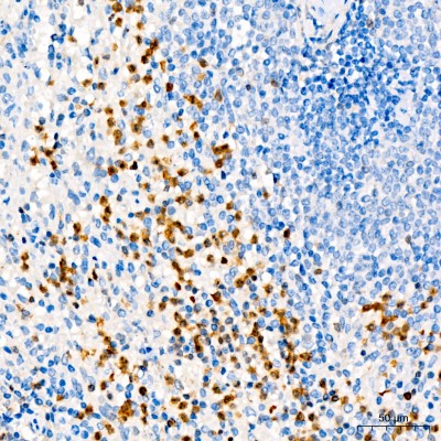 KO-Validated ANXA1 Rabbit pAb (20 μl)