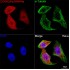 KO-Validated CDKN2A/p16INK4a Rabbit mAb (20 μl)