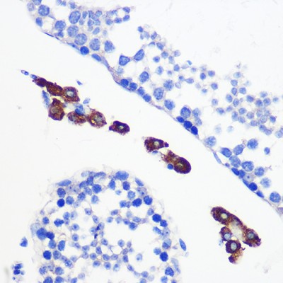 KO-Validated Bax Rabbit mAb (20 μl)