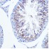 KO-Validated Fascin/FSCN1 Rabbit pAb (20 μl)