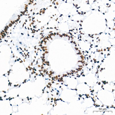 KO-Validated HDAC1 Rabbit mAb (20 μl)