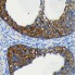 KO-Validated cIAP1 Rabbit mAb (20 μl)