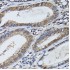 KO-Validated STAT5B Rabbit pAb (20 μl)