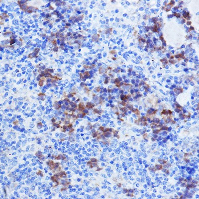 KO-Validated TYSY Rabbit pAb (20 μl)
