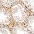 KO-Validated CDK4 Rabbit PolymAb® (20 μl)