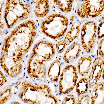 KO-Validated LAMP2 Rabbit mAb (20 μl)