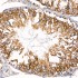 KD-Validated VDAC3 Rabbit mAb (20 μl)
