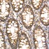 KD-Validated ECHS1 Rabbit mAb (20 μl)