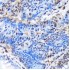 KO-Validated CTIP1/BCL11A Rabbit mAb (20 μl)