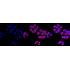 KD-Validated ROCK2 Rabbit mAb (20 μl)
