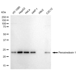 KD-Validated PRDX1 Rabbit mAb (20 μl)