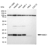 KD-Validated NME1 Rabbit mAb (20 μl)
