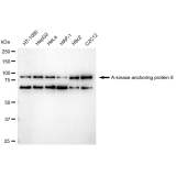 KD-Validated AKAP8 Rabbit mAb (20 μl)