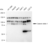 KD-Validated CTNND1 Rabbit mAb (20 μl)