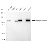 KD-Validated AR Rabbit mAb (20 μl)