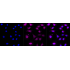 KD-Validated CBX2 Rabbit mAb (20 μl)