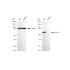 KD-Validated ACADVL Rabbit mAb (20 μl)