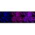 KD-Validated PFKM Rabbit mAb (20 μl)