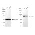 KD-Validated PFKM Rabbit mAb (20 μl)