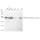 KD-Validated STIM1 Rabbit mAb (20 μl)