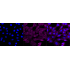 KD-Validated NFKB1 Rabbit mAb (20 μl)