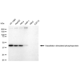 KD-Validated VASP Rabbit mAb (20 μl)