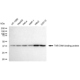 KD-Validated TARDBP Rabbit mAb (20 μl)