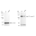 KD-Validated EPHB1 Rabbit mAb (20 μl)