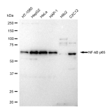 KD-Validated NF-kB p65 Rabbit mAb (20 μl)