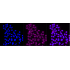 KD-Validated HER2 Rabbit mAb (20 μl)