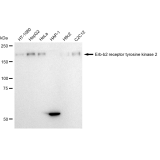 KD-Validated HER2 Rabbit mAb (20 μl)
