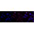 KD-Validated EphB4 Rabbit mAb (20 μl)