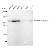 KD-Validated ACL Rabbit mAb (20 μl)