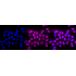 KD-Validated IKK alpha Rabbit mAb (20 μl)