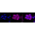 KD-Validated EGFR Rabbit mAb (20 μl)