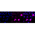 KD-Validated Phospho-PKC alpha (Ser657) Rabbit mAb (20 μl)