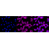 KD-Validated Fibronectin 1 Rabbit mAb (20 μl)