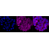 KD-Validated RRM1 Rabbit mAb (20 μl)