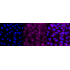 KD-Validated ABPP Rabbit mAb (20 μl)