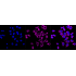 KD-Validated GRSF1 Rabbit mAb (20 μl)