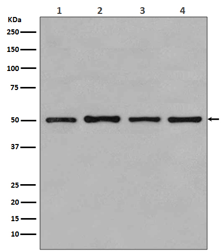 beta-Tubulin Rabbit Polyclonal Antibody
