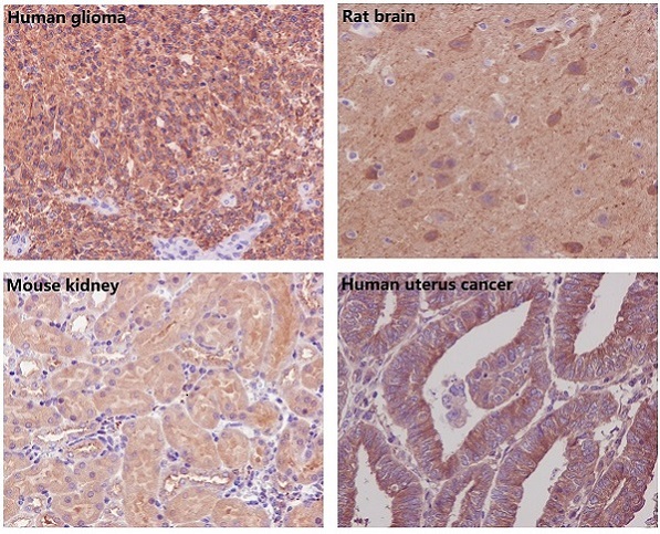 beta-Tubulin Rabbit pAb